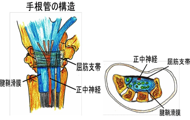 手根管症候群とは どんな病気ですか 古東整形外科 リウマチ科