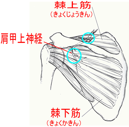 肩甲上神経麻痺 けんこうじょうしんけいまひ 古東整形外科 リウマチ科