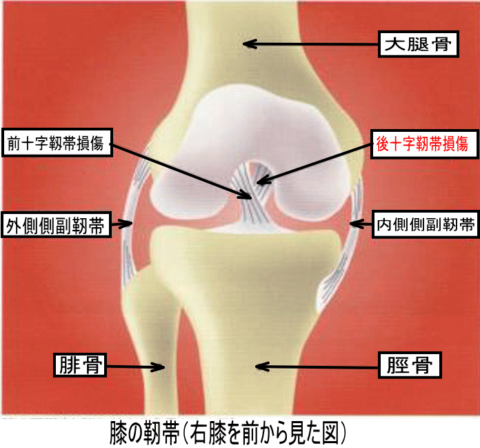 膝が崩れる原因は何 後十字靭帯損傷 古東整形外科 リウマチ科