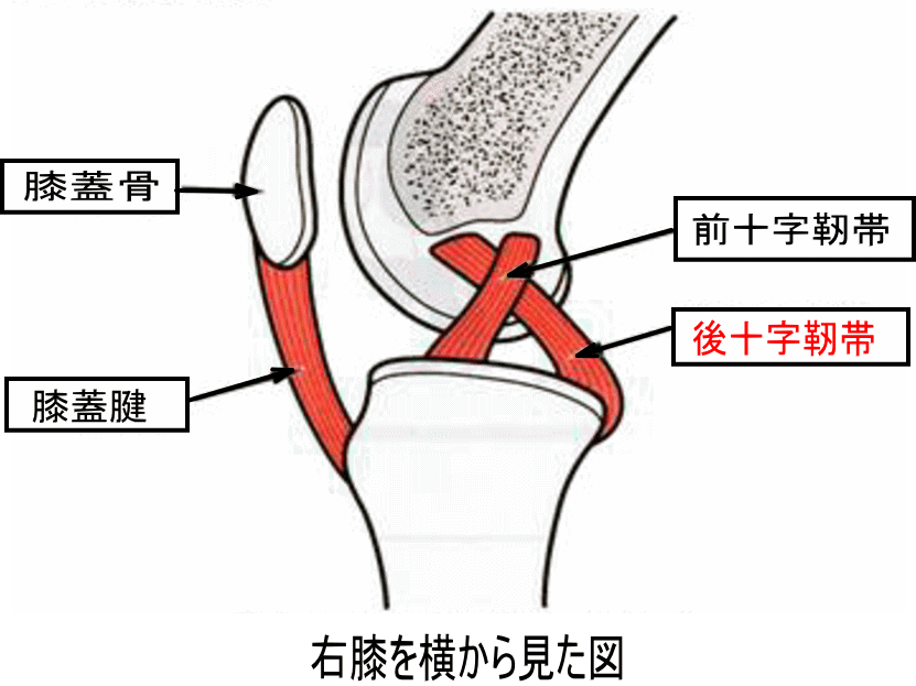膝が崩れる原因は何 後十字靭帯損傷 古東整形外科 リウマチ科