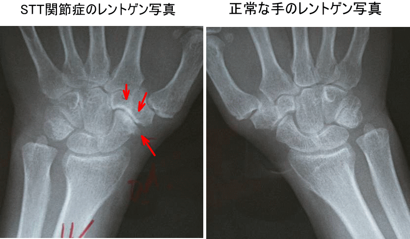 予防可能ですか？