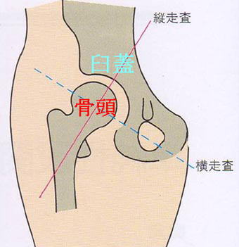 単純性股関節炎 急に子供が変な歩き方をしている 古東整形外科 リウマチ科