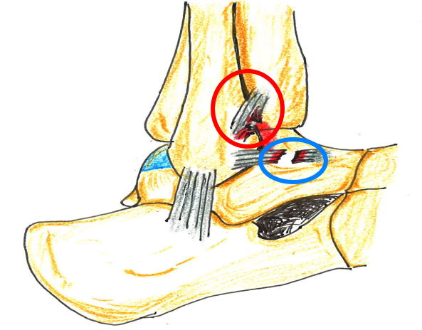 このような怪我の原因は何でしょうか?