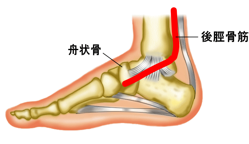 後脛骨筋機能不全 歩くと内くるぶし周辺が痛い 古東整形外科 リウマチ科