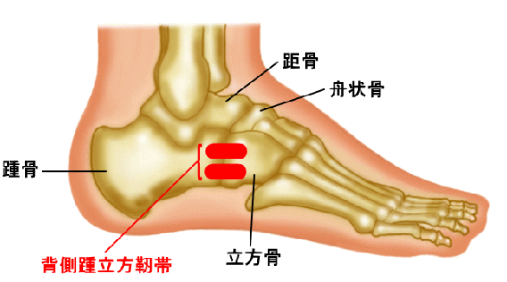 踵立方関節裂離骨折 古東整形外科 リウマチ科