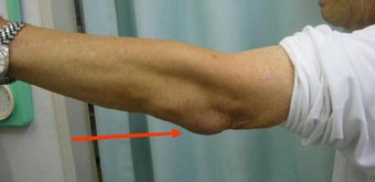 医師の診察を受ける時期