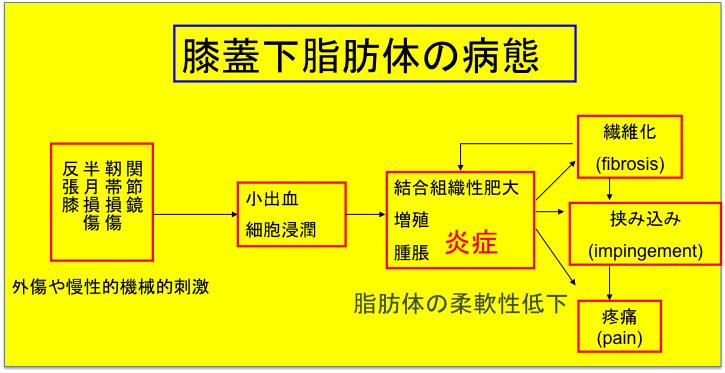 Hoffa病 膝蓋下脂肪体炎 膝の曲げ伸ばしを繰り返すと 膝の前面が痛い 古東整形外科 リウマチ科