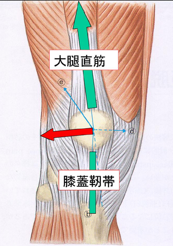 膝蓋骨不安定症の発症要因 怪我をしたわけでもないのに膝が痛い 古東整形外科 リウマチ科