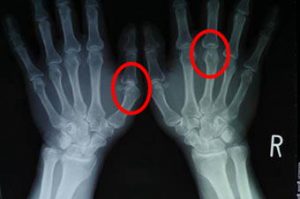 8. マッサージを受ける