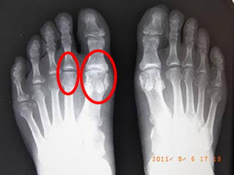 食生活を変えたほうがいいでしょうか?