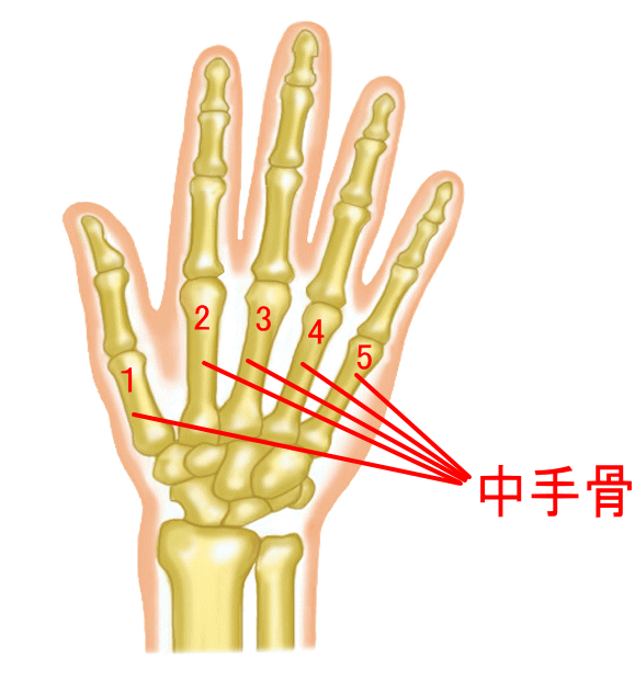 第一中手骨基部骨折 親指の付け根を骨折してしまった ギプスか手術かどっちがいいの 古東整形外科 リウマチ科