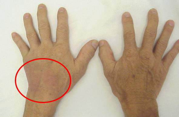 手首関節の解剖学