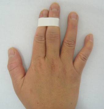 手指の側副靭帯損傷 指の関節の横が痛い 古東整形外科 リウマチ科