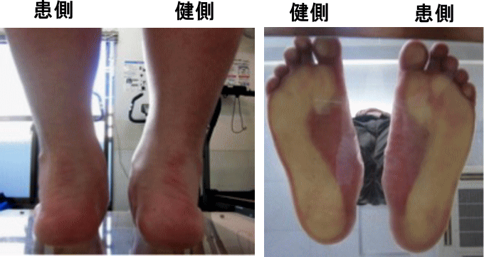 4. カーフレイズ