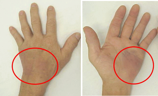 医師の診察を受ける時期