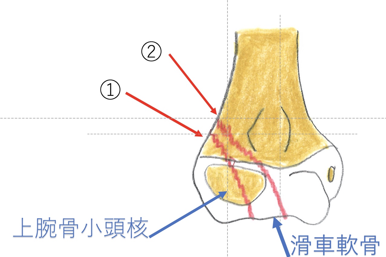 種類は何ですか?